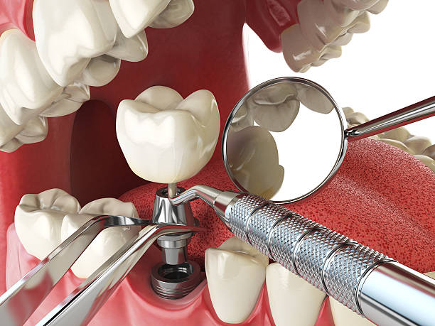 Best Emergency Root Canal Treatment in Doe Valley, KY